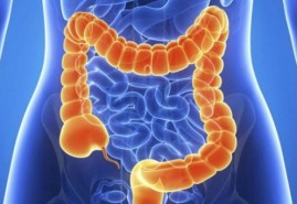 5 Makanan Sederhana Cegah Kanker Usus